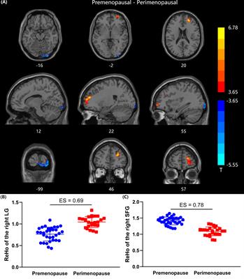 Altered Spontaneous Brain Activity in Women During Menopause Transition and Its Association With Cognitive Function and Serum Estradiol Level